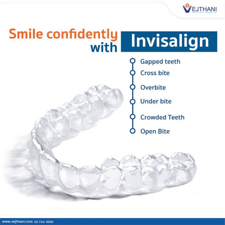 Invisalign