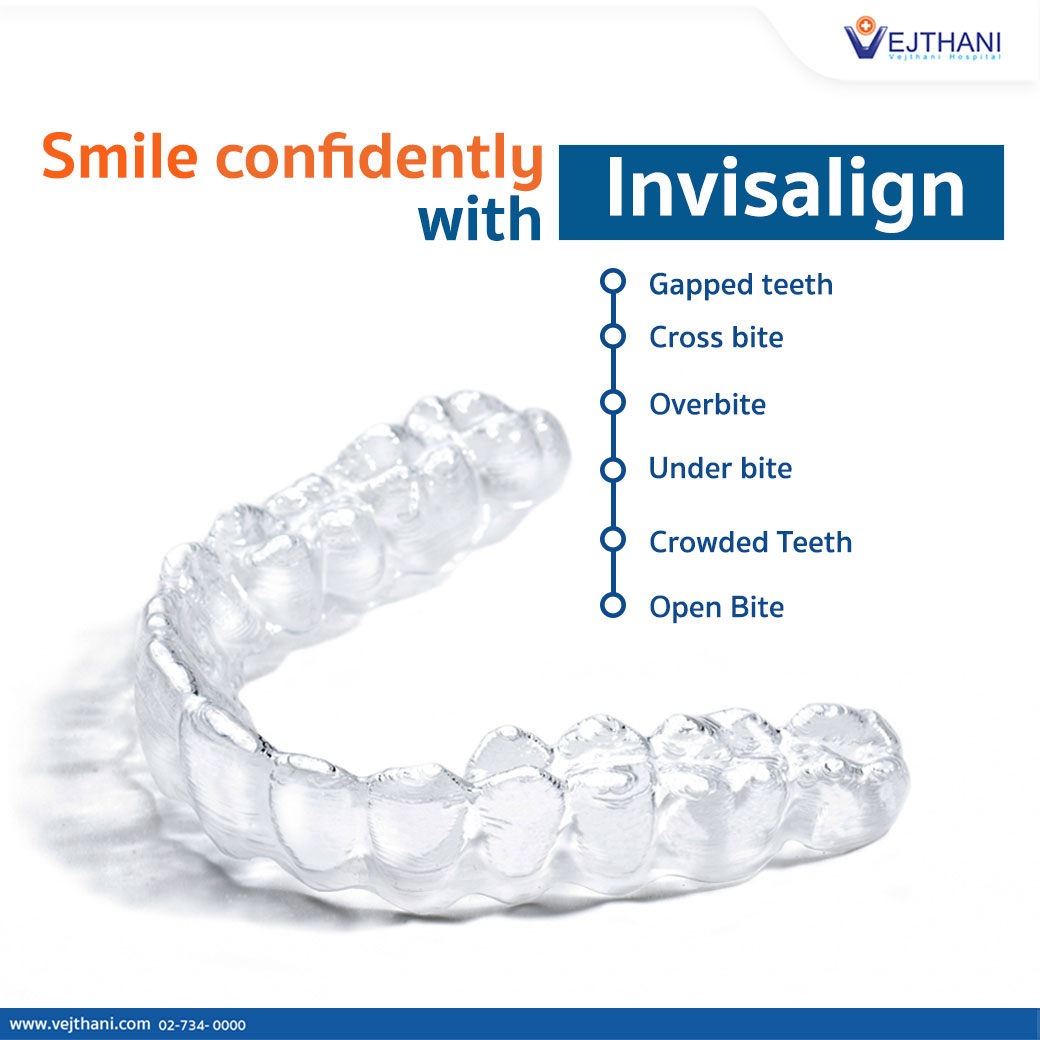 Invisalign