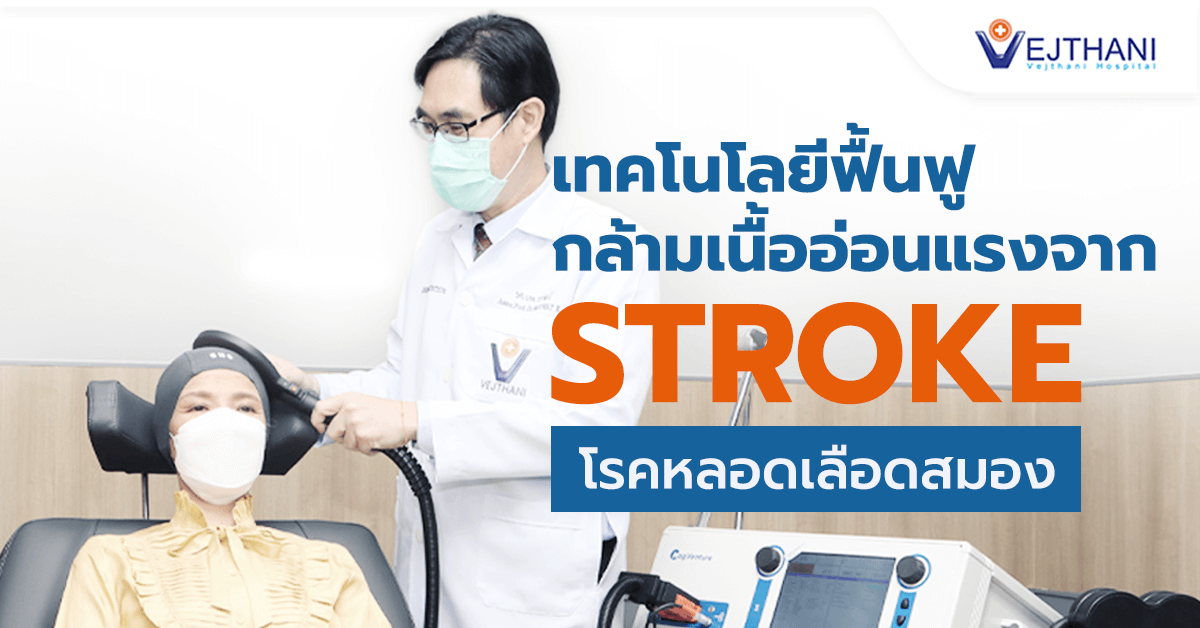 Exploring the Potential of TMS: Recover Muscle Weakness Caused by Cerebrovascular Disease