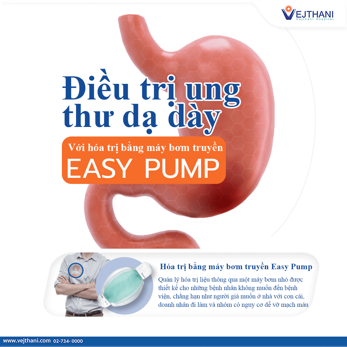 Điều trị ung thư dạ dày với hóa trị bằng máy bơm truyền Easy Pump