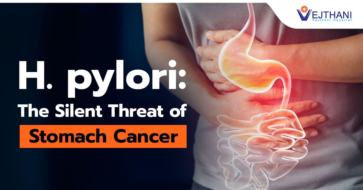 H. pylori: The Silent Threat of Stomach Cancer