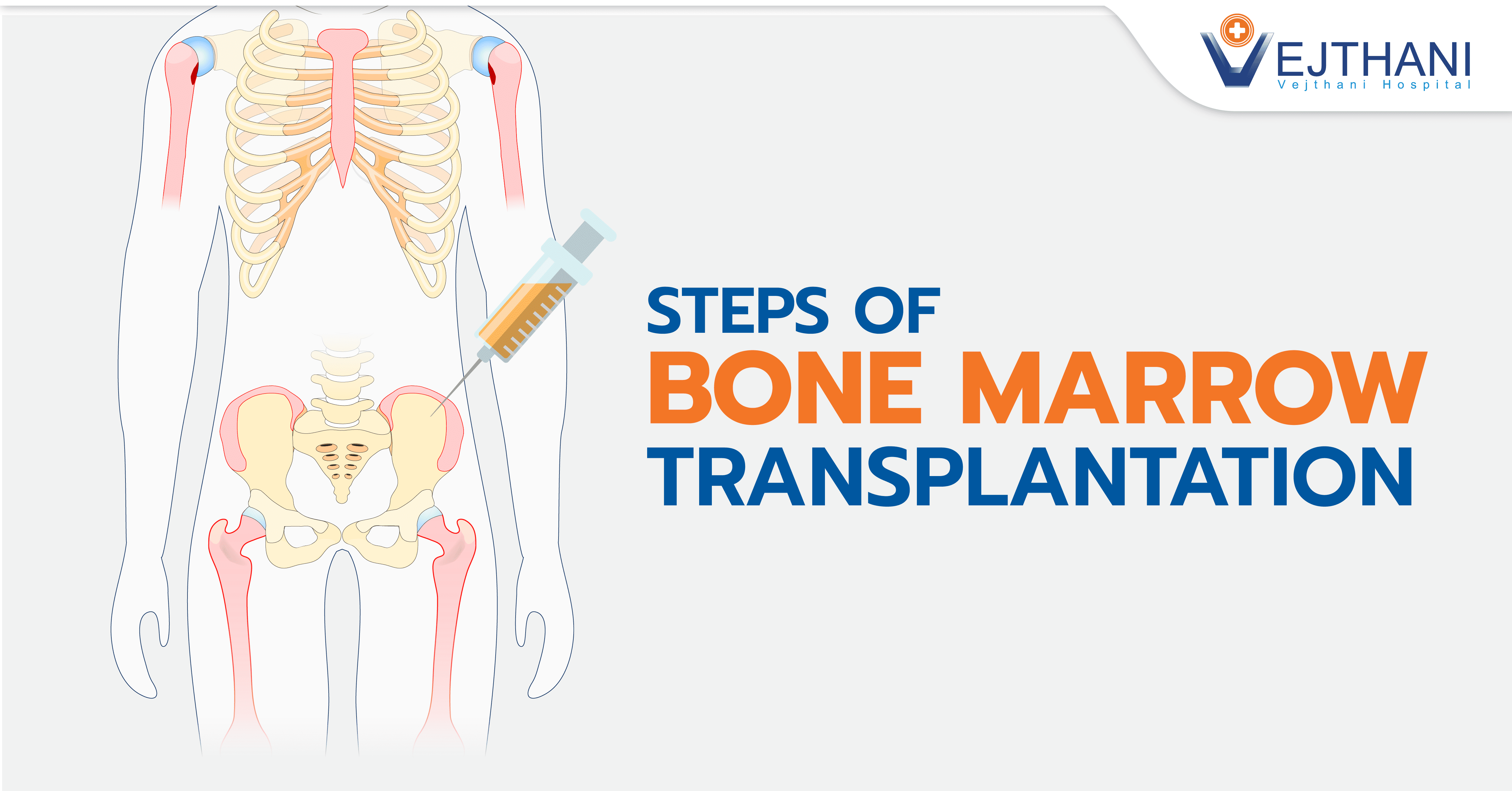 Steps of Bone Marrow Transplantation